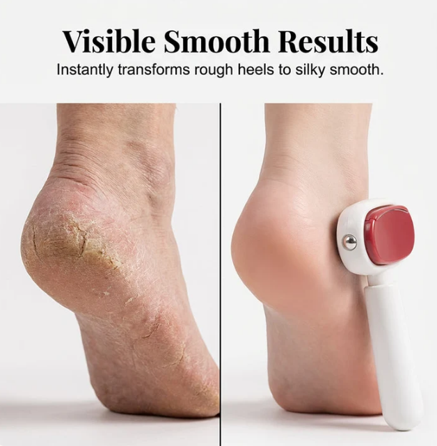 Dual‑Sided Foot Callus Remover, Replaceable Stainless Steel Blade Foot Scraper 🦶