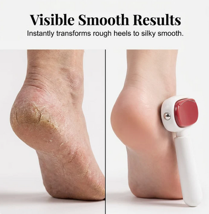 Dual‑Sided Foot Callus Remover, Replaceable Stainless Steel Blade Foot Scraper 🦶
